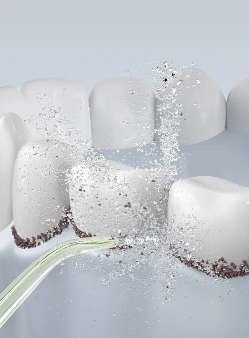 Xiaomi Oclean dental flusher W10, Green